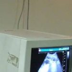 बेकायदेशीर सोनोग्राफी सेंटर चालवणाऱ्यांकडे लिंगनिश्चिती करणाऱ्या जोडप्यांचा पोलीस शोध घेणार आहेत